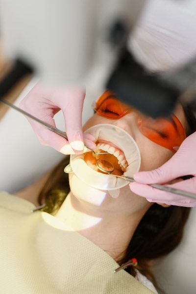 Donna con bocca a perta per servizio dentale